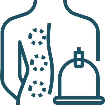 Cupping therapy on the back.