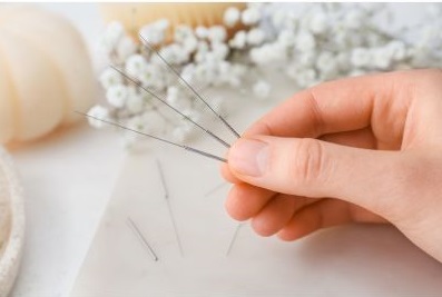 Acupuncture needles.